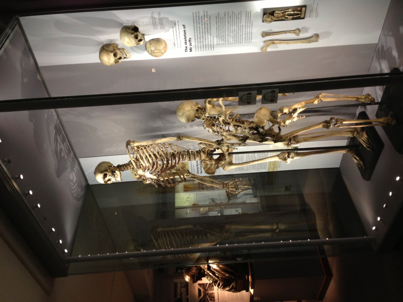 Muzeu Hunterian  - 35-43 Lincoln's Inn Fields | Secret World Trip Planner